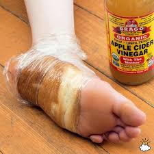 Searching for instructions on how to perform an apple cider vinegar foot soak? Wrap Your Feet In Bread And Saran Wrap To Naturally Remove Yucky Corns And Calluses Health Remedies Remedies Foot Remedies