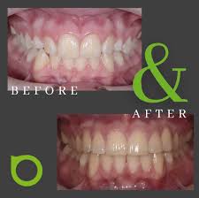 Dr David Bachmayer (@bachmayer.orthodontics) • Instagram photos and videos