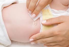 An umbilical granuloma does not cause pain. Newborn Umbilical Cord Bleeding Reasons Treatment