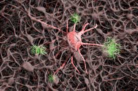 It interferes with your brain's ability to control your body. Anokion Starts Patient Dosing In Multiple Sclerosis Drug Trial