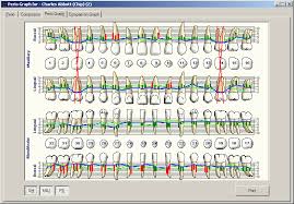 Your Gum Chart Whats The Big Deal Lake Baldwin Dental