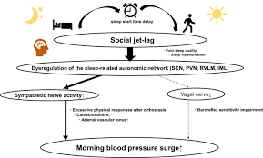 Image result for Jet Lag