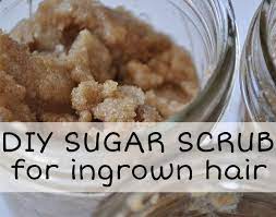 Diy Sugar Scrub For Ingrown Hair Prevention Treatment Beautymunsta Free Natural Beauty Hacks And More In 2020 Sugar Scrub Diy Ingrown Hair Prevent Ingrown Hairs
