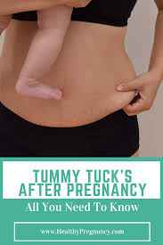 When Can You Have A Tummy Tuck After C Section Pin On Postpartum Tips