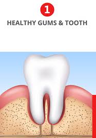 Check spelling or type a new query. Gum Disease 101 What You Don T Know Can Kill You Millennium Dental Technologies Inc