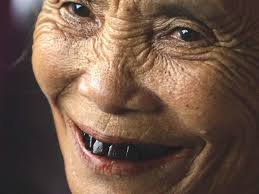 White spots on teeth are the initial stages of indication of dental fluorosis. White Spots On Teeth 11 Tips On How To Get Rid Of Them