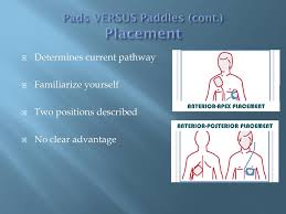 By hugo delgado, jorge toquero, cristina mitroi, victor castro the purpose of this chapter is to review the mechanisms of external defibrillation, the available types. Paediatric Defibrillation Ppt Download