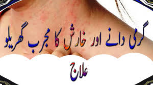 Maybe you would like to learn more about one of these? Garmi Danay Khatam Karne Ka Tarika In Urdu Video Dailymotion