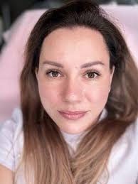 Skin Renewal Facial Studio, 7996 California Ave, Ste C Rm 1, Fair Oaks, CA  95628, US