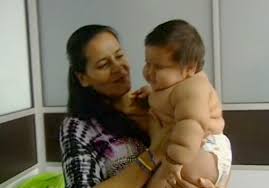 Il est donc normal de moins le sentir bouger au cours de la journée. Santiago Ce Bebe Colombien De 8 Mois Qui Pese 20 Kilos Elle