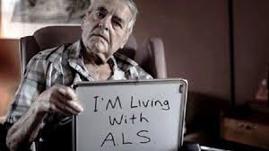 Amyotrophic lateral sclerosis (als) is a progressive neurodegenerative disease that affects nerve cells in the brain and the spinal cord. Mengenal Penyakit Als Pembunuh Senyap Yang Lebih Banyak Diderita Laki Laki Tribun Jogja