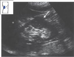 0 public playlist includes this case. Kidneys Radiology Key