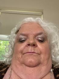 Hi my name is Loreen . I live in south of Ireland . I have asthma & COPD  with the past 22 years . Had a bad attack 5 weeks ago was