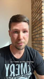 When your eyes betray you but you still have deals to close 🤦‍♂️😂, Anyone  else ever react to laundry detergent like this? Asking for a friend.,  #RealtorLife #AustinTXRealEstate #HouseHunting ...