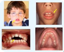 La respiración afecta a tu salud bucal