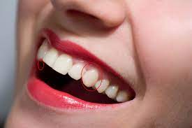 Plastic vampire teeth silver spray paint cardstock labels fake blood tools: Vampire Teeth Image And Photo Touch Ups Paint Net Forum