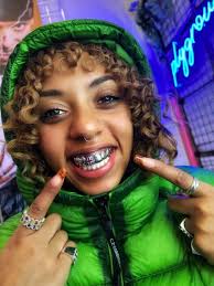 From £35 crystals to £30,000 diamonds: the jaw-dropping rise of tooth  jewellery