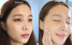 4 DÒNG SERUM MESOESTETIC CHUYÊN BIỆT CHO TỪNG LOẠI DA