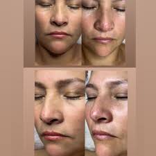 Gloria Skin Care Los Angeles, CA