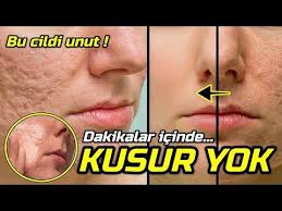 Sen Cal Yuzune O Halletsin Kusur Leke Yok Edici Gozenek Kapatici Beyazlatici Guzellik Bakim Youtube 2020 Dogal Cilt Dogal Cilt Bakimi Cilt Bakimi