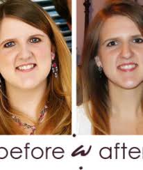 My Weight Loss Story