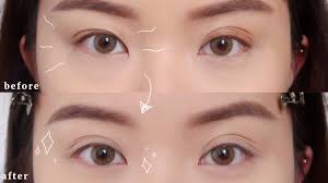 Maybe you would like to learn more about one of these? How I Fix My Uneven Eyelids Naturally Youtube