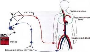 Сравните цены и выберите лучшее предложение. Https Xn J1aeg1d Xn P1ai Obrazovanie Stati 265 Ekstrakorporalnaya Membrannaya Oksigenatsiya U Patsientov S Tyazheloj Dykhatelnoj Nedostatochnostyu I Pervyj Opyt Ee Primeneniya Vo Vremya Aviatsionnoj Meditsinskoj Evakuatsii V Rossii