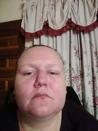 Hi! Im new to the group🤗 I have Sjogrens, Lupus (SLE), Hashimoto disease,  TMJ, trigger finger, Cronic Depression, Anxiety, OCD degenerative disc  disease, Migraines, Spondylitis of cervical spine & lumbar spine, IBS,