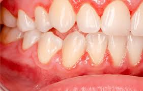 You need to find out what's causing the problem, and. 11 Reasons Why Your Gums Are Itchy