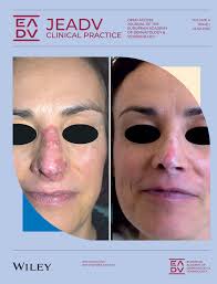 JEADV Clinical Practice