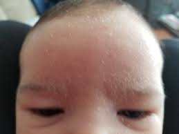 If your baby's scalp seems to be dry and flaking, try to wash their hair when bathing your newborn, gently rub your baby's scalp with your fingers or a washcloth to loosen the scales. Baby Oil For Newborn Dry Scalp Newborn Baby