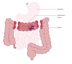 Hindi language is full of loan words and you would be amazed to see, many words that we use in our daily conversation have foreign origins. Anastomosis Definition Techniques Types And Risks