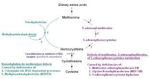 Image result for Homocystinuria