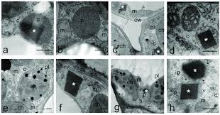 Maybe you would like to learn more about one of these? Peroxisome Ultrastructure Of Leaf Mesophyll Cells From Seedlings Of Download Scientific Diagram
