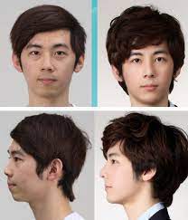 31 Crazy Before And After Photos Of Korean Plastic Surgery Korean Plastic Surgery Plastic Surgery Pictures Cosmetic Surgery