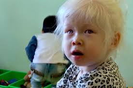 Fundraiser by Amy Galm : Bringing Eloise Home