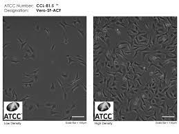After cells grow to high concentration seed virus is added to the culture to infect the cell and produce more virus particles. Vero Cells Green Kidneys To Produce Vaccines