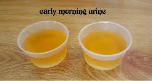 Natural Ways To Do Pregnancy Test Using Salt Sugar Onion Toothpaste Stay Natural Health