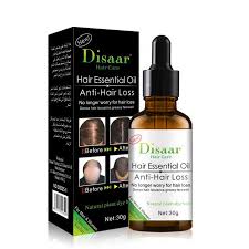 I've tried many hair loss products and provide information in order to try help provide readers information based on my opinion and experience as well as feedback from countless hair loss sufferers. Professional Oil Anti Hair Loss And Hair Growth