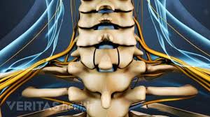 Pin On Spine Surgery
