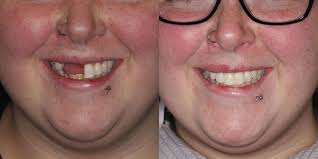 Transformative Dental Before & After