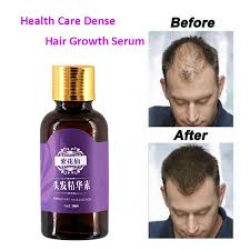 It contains a unique profile of amino acids that provide the building blocks for healthy skin, hair, and nails. 20ml Fast Hair Growth Faster Grow Hair Regrowth For Men Women Pure Natural Hair Loss Products Pilatory Treatment Anti Hair Loss Essence Holder Essence Mineralessence Makeup Aliexpress
