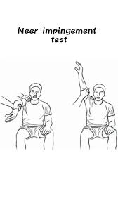 Image result for Pelvic Compression Test