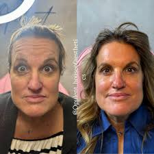 Alexis Collins-Jones, FNP-C| Medical Aesthetics| Baton Rouge, La