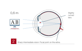 Image result for Presbyopia
