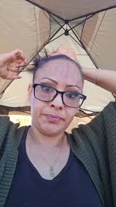 Day 2 after fibroblast treatment !