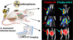Image result for Striga baumannii