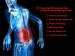 Đau vùng thắt lưng là dấu hiệu của bệnh gì?