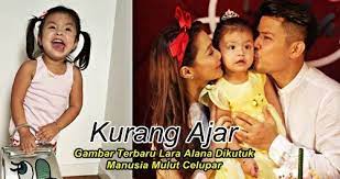 Alana down syndrome center at mit, cambridge, massachusetts. Anak Scha Awal Dihina Dengan Kejam 5 Gambar Manusia Wajah Pengikut