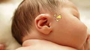 Benjolan di leher sering terjadi dan biasanya jinak. Ada Benjolan Di Belakang Telinga Bayi Yuk Cek Penyebab Dan Cara Mengatasinya Orami